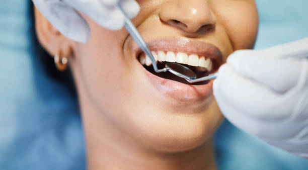 Best Knocked-Out Tooth Emergency  in Paris, IL